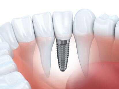 LH Dental Studio - Cabinet Stomatologic, Sector 3